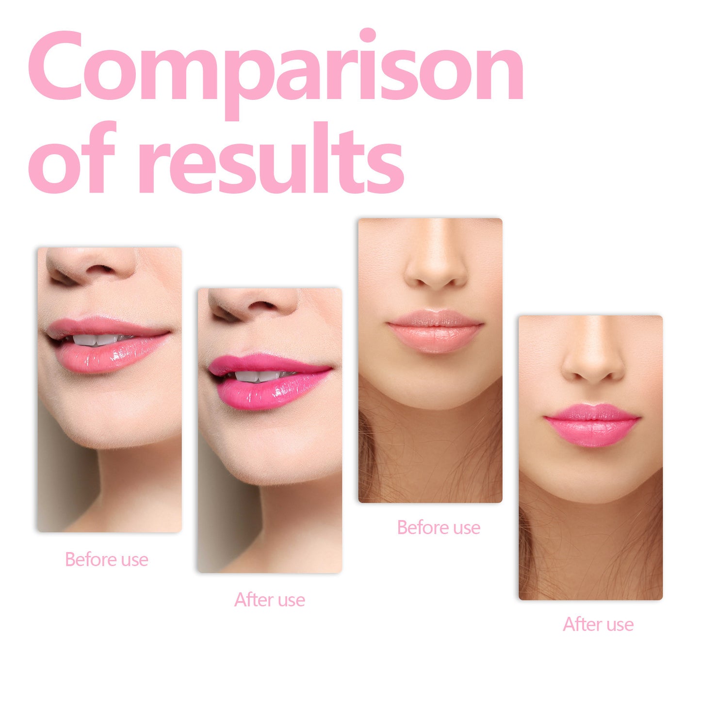 Nourishing Lip Care Oil - Smooths Fine Lines & Moisturizes
